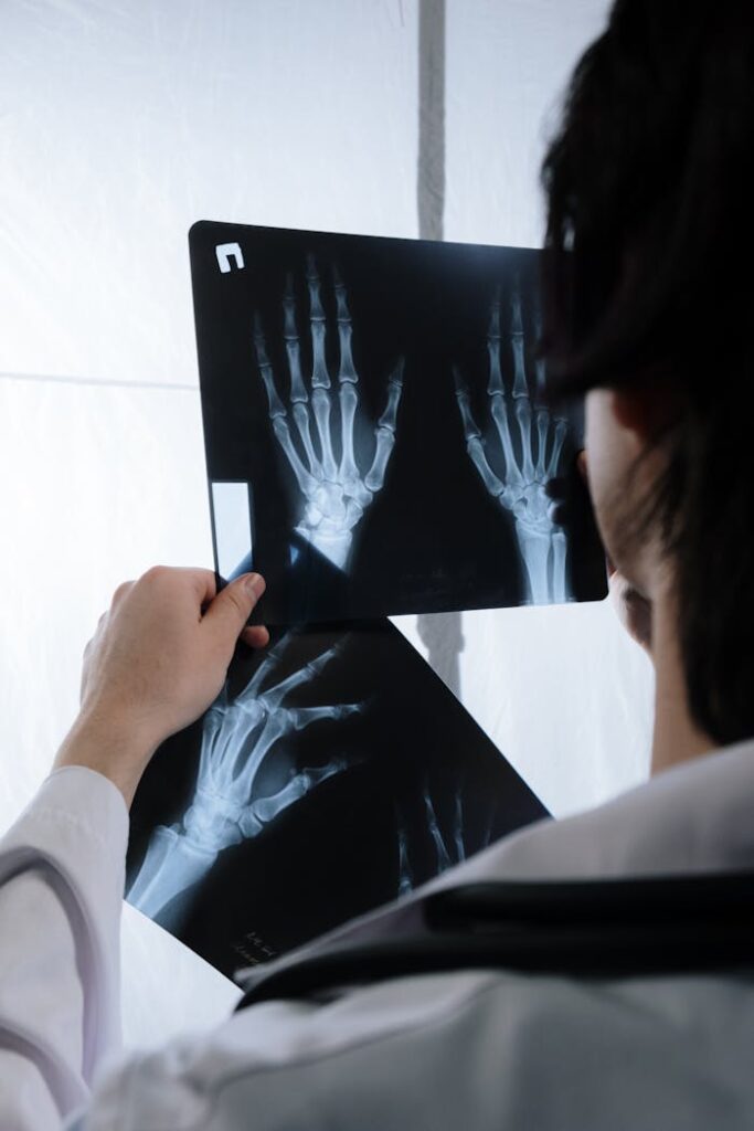 A doctor examines hand x-ray images to assess possible fractures or injuries.